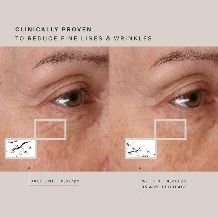 HigherDose Red Light Face Mask: The 7-Minute Secret That's Making 40-Year-Olds Look 25