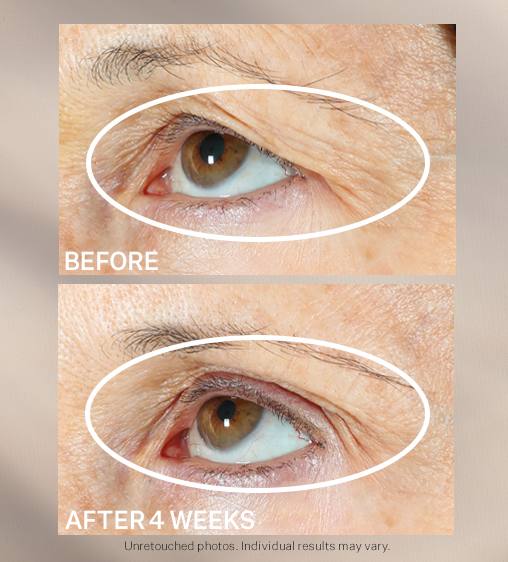 Best Eye Serum for Wrinkles and Dark Circles That Visibly Lifts, Brightens, and Firms the Entire Eye Area in 21 Days — So You Stop Reaching for Concealer Every Single Morning